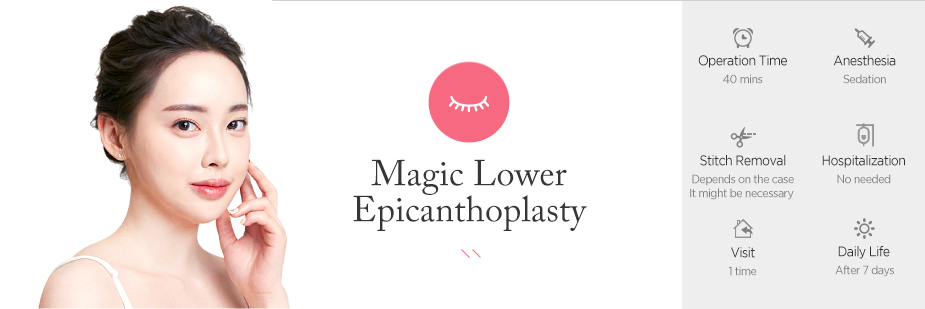 Magic Lower Epicathoplasty operation time - 40 mins / Anesthesia - sedation / Stitch Removal - Depends on the case it might be nexessary / Hospitalization - No needed / Visit - 1 time / Dailt Life - After 7 days